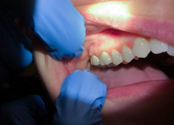 Best After-Hours Dental Trauma Care in Rk Forest Village, PA